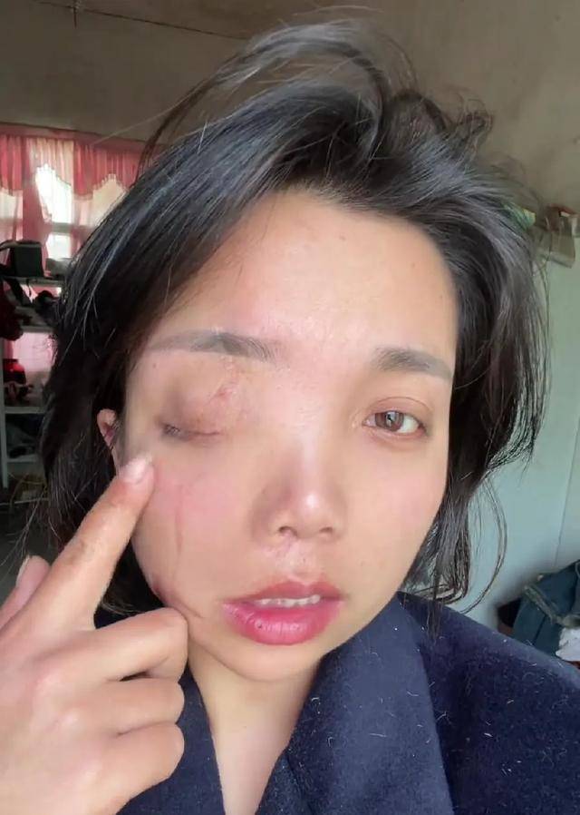 皇冠信用网怎么开户_安徽女子左眼失明皇冠信用网怎么开户，办理残疾人证被拒？残联：双眼残疾可办理