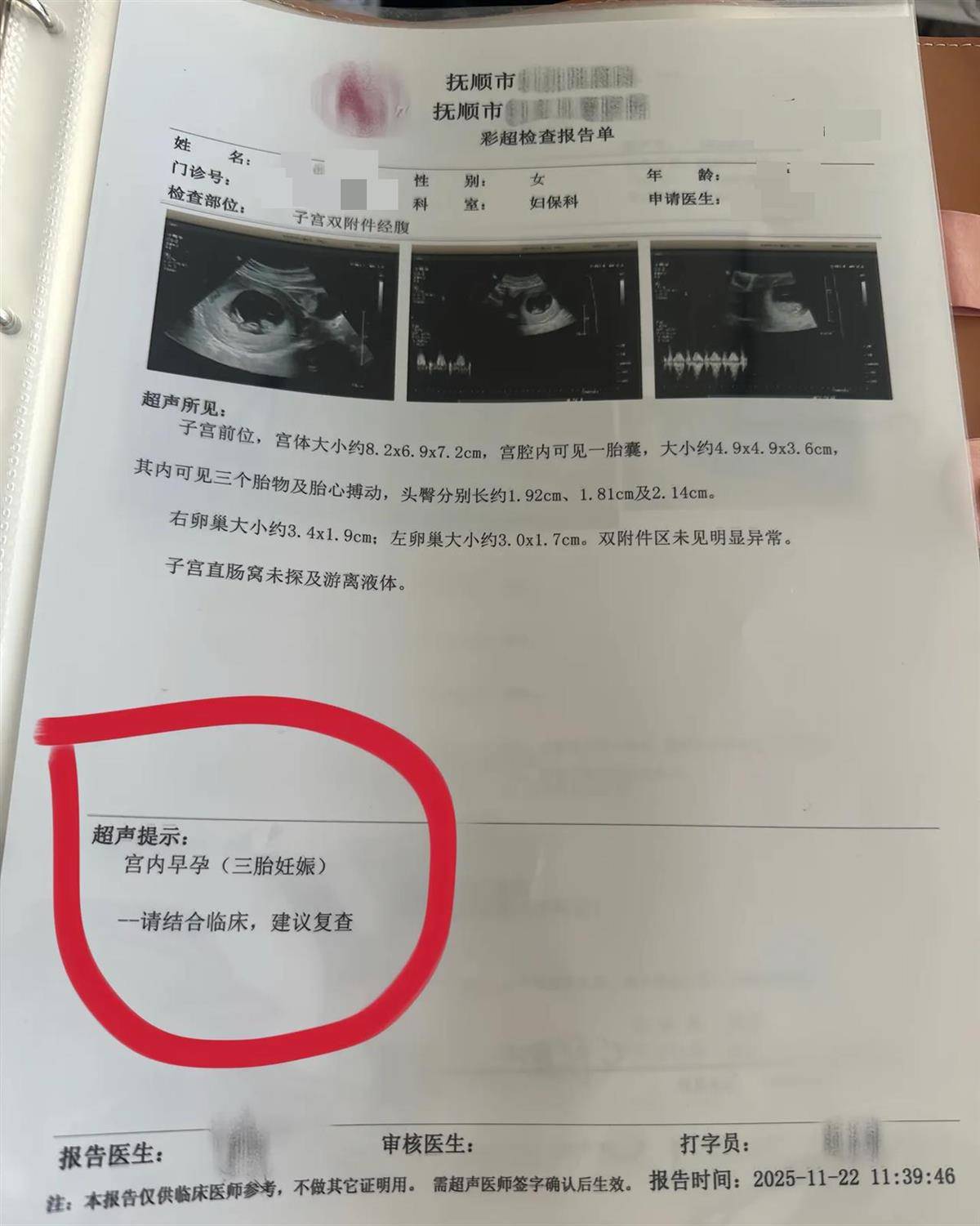 怎么开通皇冠信用开户_辽宁一孕妇两个月内从一胎变四胞胎怎么开通皇冠信用开户,每次产检发现多出一胎,医生:系同卵四胞胎,概率1300万至1500万分之一